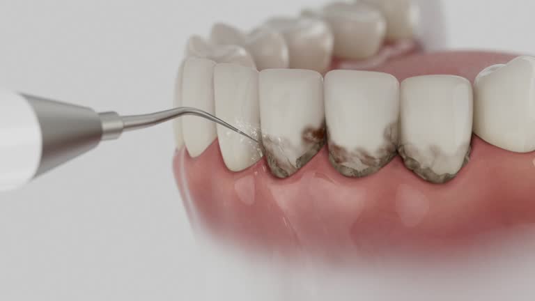 Trusted Wisdom Tooth Removal service in Tazewell, TN - Dentist Open Now